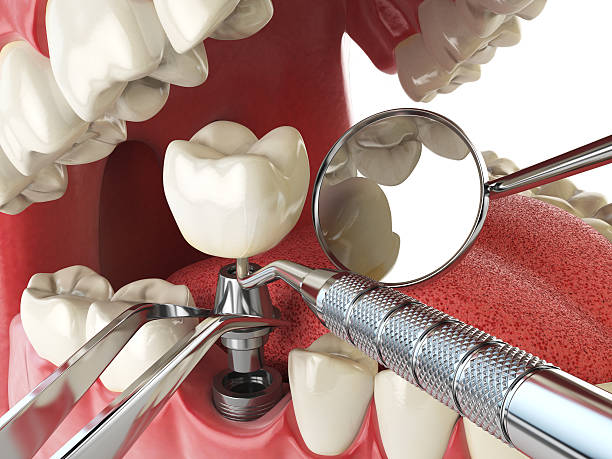 Best Emergency Root Canal Treatment in Roosevelt, UT
