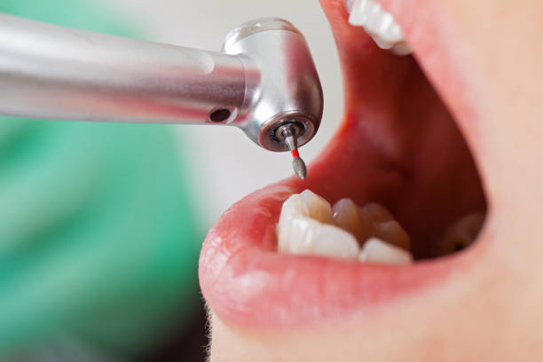 Best Emergency Cosmetic Dentistry in Roosevelt, UT